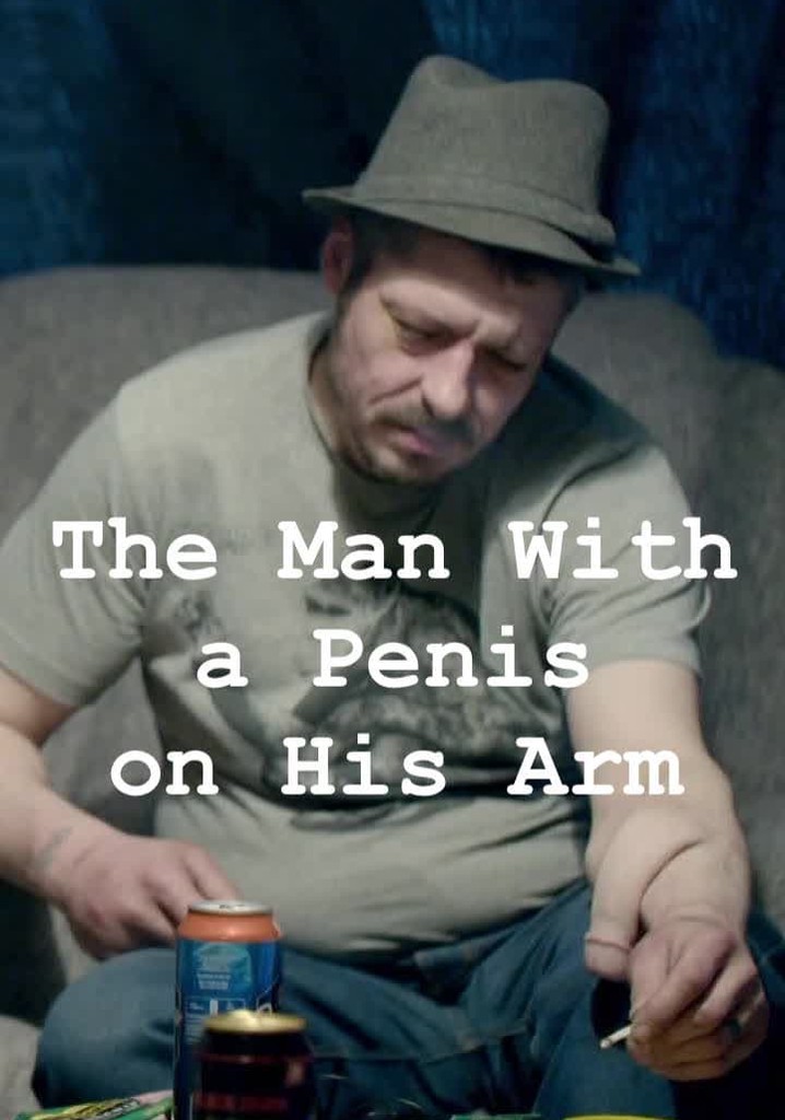 The Man With A Penis On His Arm Stream Online 2594